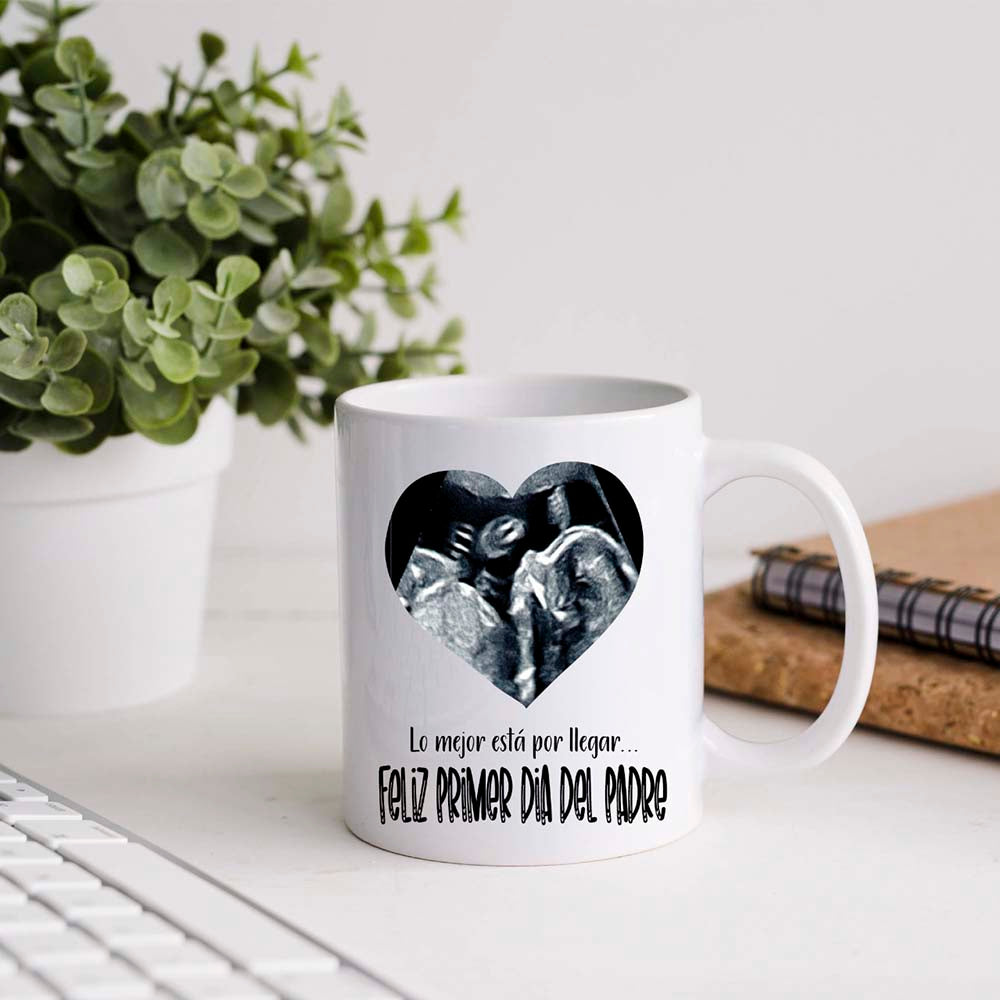 Taza Ecografía